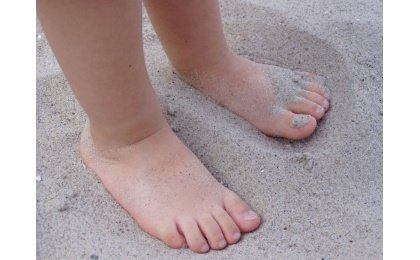 Podologia pediàtrica